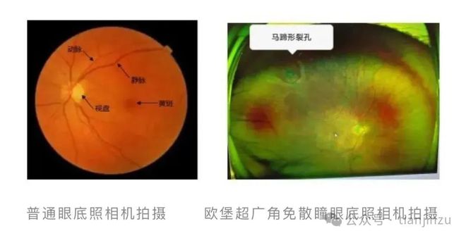 有测眼型软件没_有没有测眼型的软件_测眼型的软件下载