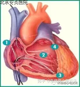 阵发性室上性心动过速的治疗_阵发性房性心动_阵发性室性心动过